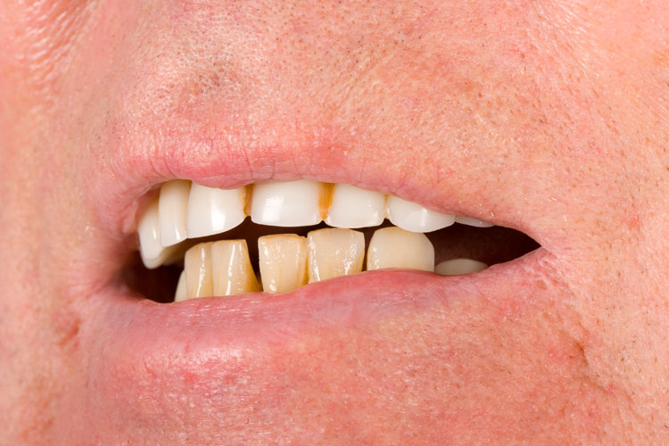 Before Image