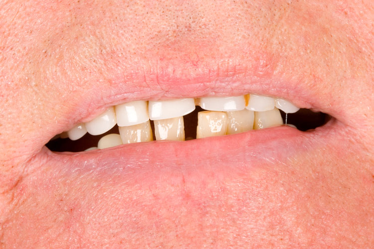 Before Image