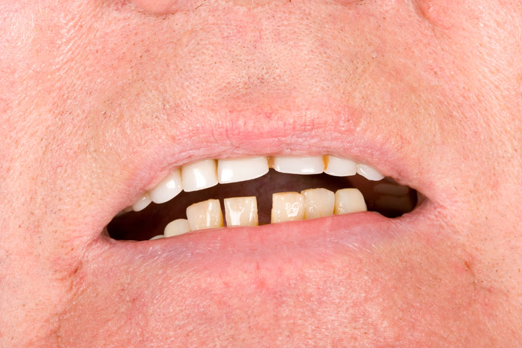 Before Image
